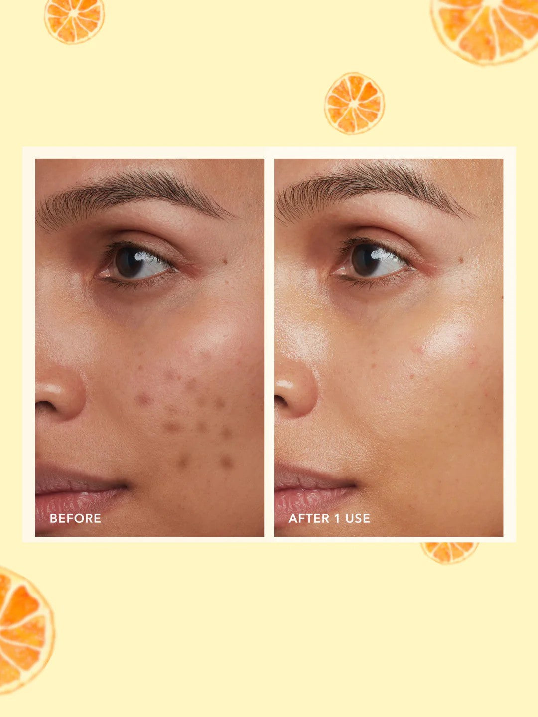 LAKYOU BEAUTY Vitamin C Face Serum 50ml | 98% Pure Vitamin C Complex | Serum for All Skin Types