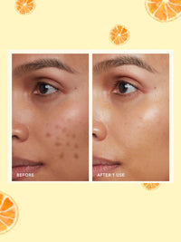 LAKYOU BEAUTY Vitamin C Face Serum 50ml | 98% Pure Vitamin C Complex | Serum for All Skin Types