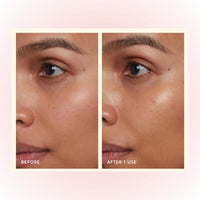LAKYOU BEAUTY Hydro Boost Water Based Moisturizer 50g | Lightweight Hydrating Face Gel Cream | All Skin Types